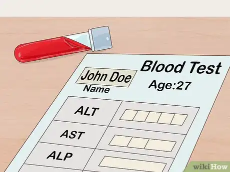 Image intitulée Test Liver Function Step 7