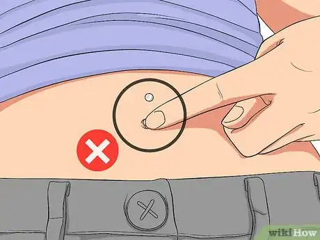 Image intitulée Treat an Irritated Belly Button Piercing Step 9