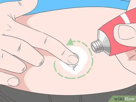 Image intitulée Treat an Infection in Your Belly Button Step 7