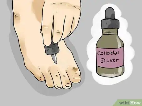 Image intitulée Use Apple Cider Vinegar for Athlete's Foot Step 10