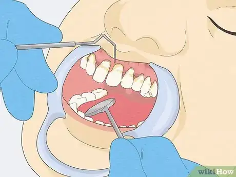 Image intitulée Fix Rotting Teeth Step 5