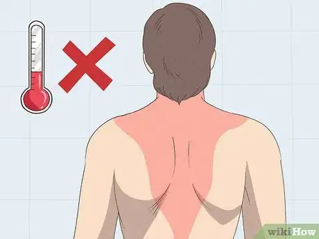 Image intitulée Heal a Pulled Trapezius Muscle Step 11