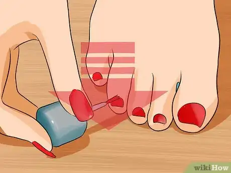 Image intitulée Get Rid of Yellow Toenails Step 7