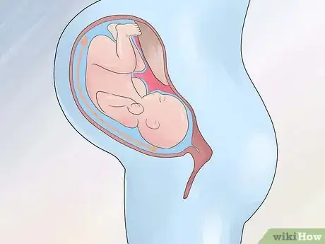 Image intitulée Increase Amniotic Fluid Step 13
