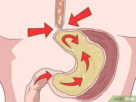 Image intitulée Know if You Have Laryngitis Step 16