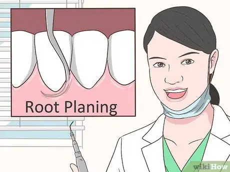 Image intitulée Clean Your Gums Step 10