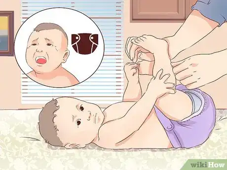 Image intitulée Treat Constipation in Newborns Step 1