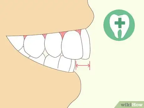 Image intitulée Stop Biting Your Lips Step 7