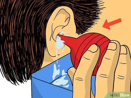 Image intitulée Get Rid of Swimmer's Ear Step 7