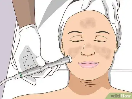 Image intitulée Treat Melasma Step 7