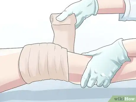 Image intitulée Know if You Have a Baker's Cyst Step 11