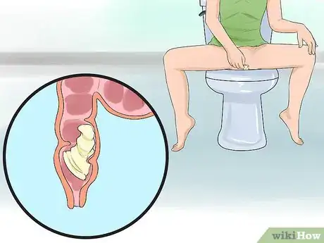 Image intitulée Remove a Condom Stuck Inside Step 9