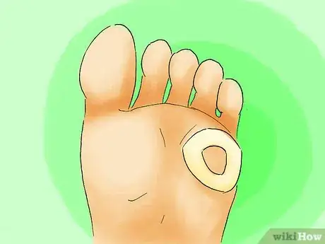 Image intitulée Remove Corns from Your Toes Step 07