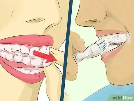 Image intitulée Whiten Teeth Step 10