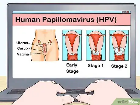 Image intitulée Have Sex with HPV Step 1