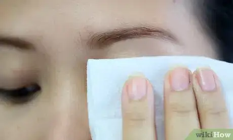 Image intitulée Get Rid of Puffy Eyelids Step 1