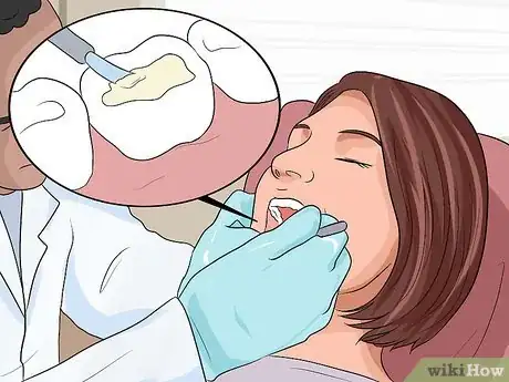 Image intitulée Restore Tooth Enamel Step 11