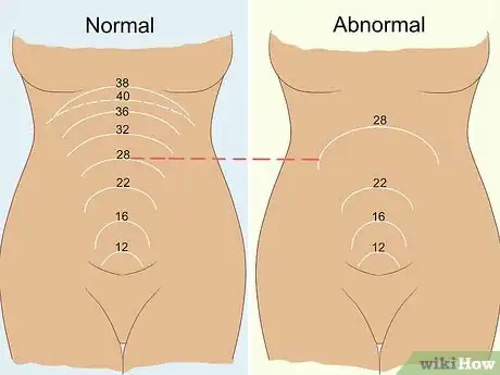 Image intitulée Measure Fundal Height Step 8