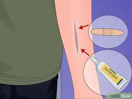 Image intitulée Make a Quick Disinfectant for Minor Cuts and Abrasions Step 9