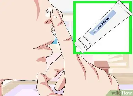 Image intitulée Get Rid of a Nose Ring Bump Step 3