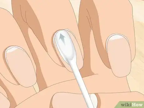 Image intitulée Heal Cuticles Step 5