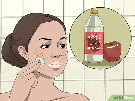 Image intitulée Dry Out a Pimple Step 16