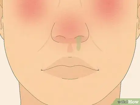 Image intitulée Make Saline Nasal Spray Step 16
