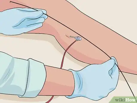 Image intitulée Get Rid of Varicose Veins Step 12