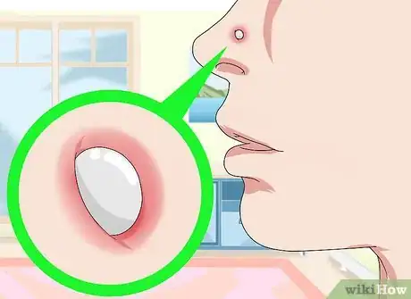 Image intitulée Get Rid of a Nose Ring Bump Step 8
