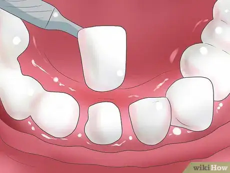 Image intitulée Bleach Your Teeth Step 12