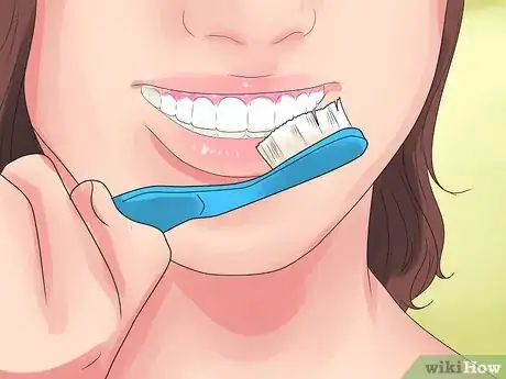 Image intitulée Alleviate Orthodontic Brace Pain Step 14