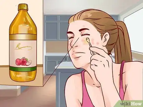 Image intitulée Get Rid of a Deep Pimple Step 12