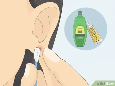 Image intitulée Clean Your Ear Piercing Step 10