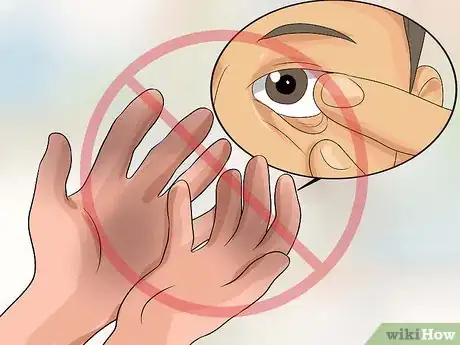Image intitulée Remove Stuck Contact Lenses Step 15