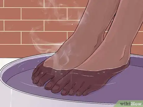 Image intitulée Get Rid of Plantar Warts (Verrucas) Step 2