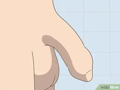 Image intitulée Regrow Foreskin Step 1