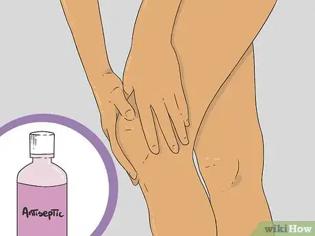 Image intitulée Shave Your Legs Step 21