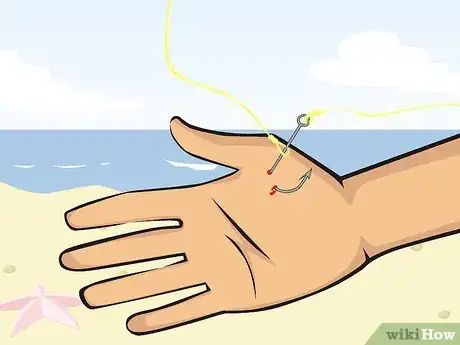 Image intitulée Pull a Fish Hook from Your Finger Step 11