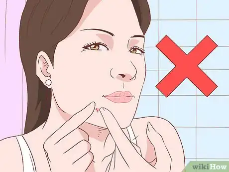 Image intitulée Get Rid of Acne Without Using Medication Step 30