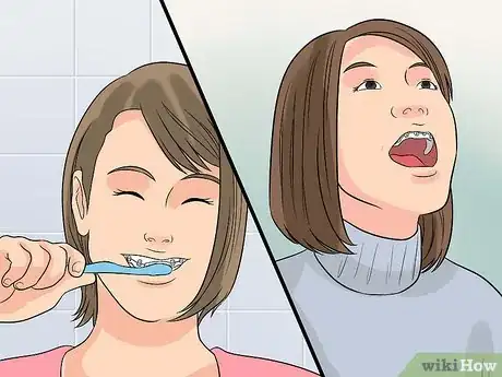 Image intitulée Prepare on the Day You Get Braces Step 15