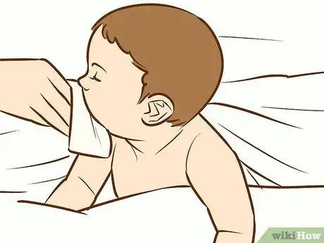 Image intitulée Treat Neck Rashes for Your Baby Step 4