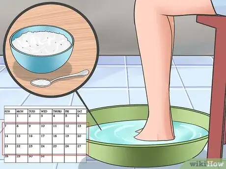 Image intitulée Tell if You Have an Ingrown Toenail Step 11