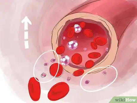 Image intitulée Increase Platelets Step 3