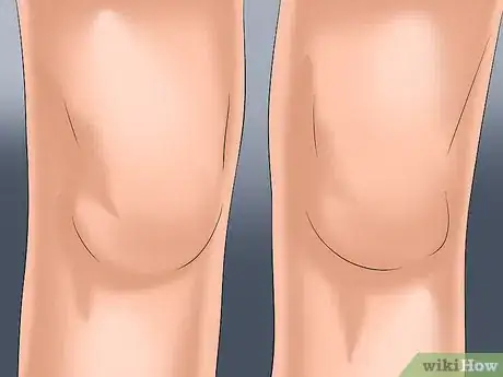 Image intitulée Get Rid of Arthritis Pain Step 9