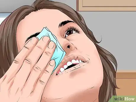 Image intitulée Heal a Scratched Cornea Step 14