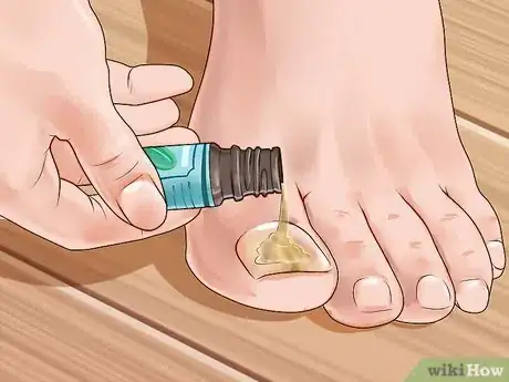 Image intitulée Use Essential Oils Step 7