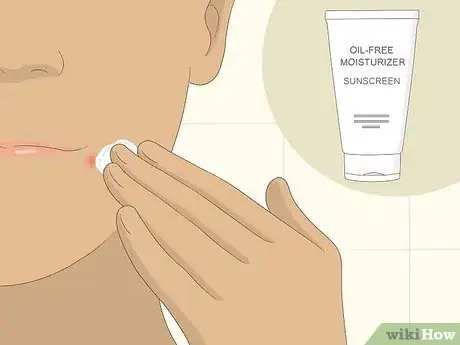 Image intitulée Get Rid of Acne Redness Fast Step 11