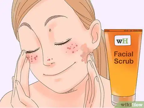 Image intitulée Remove the Redness of a Pimple Step 19