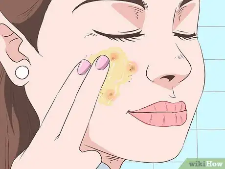 Image intitulée Quickly Heal Open Sores on Your Face Step 3