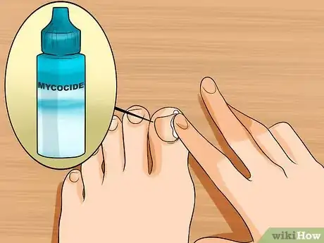 Image intitulée Get Rid of Yellow Toenails Step 2